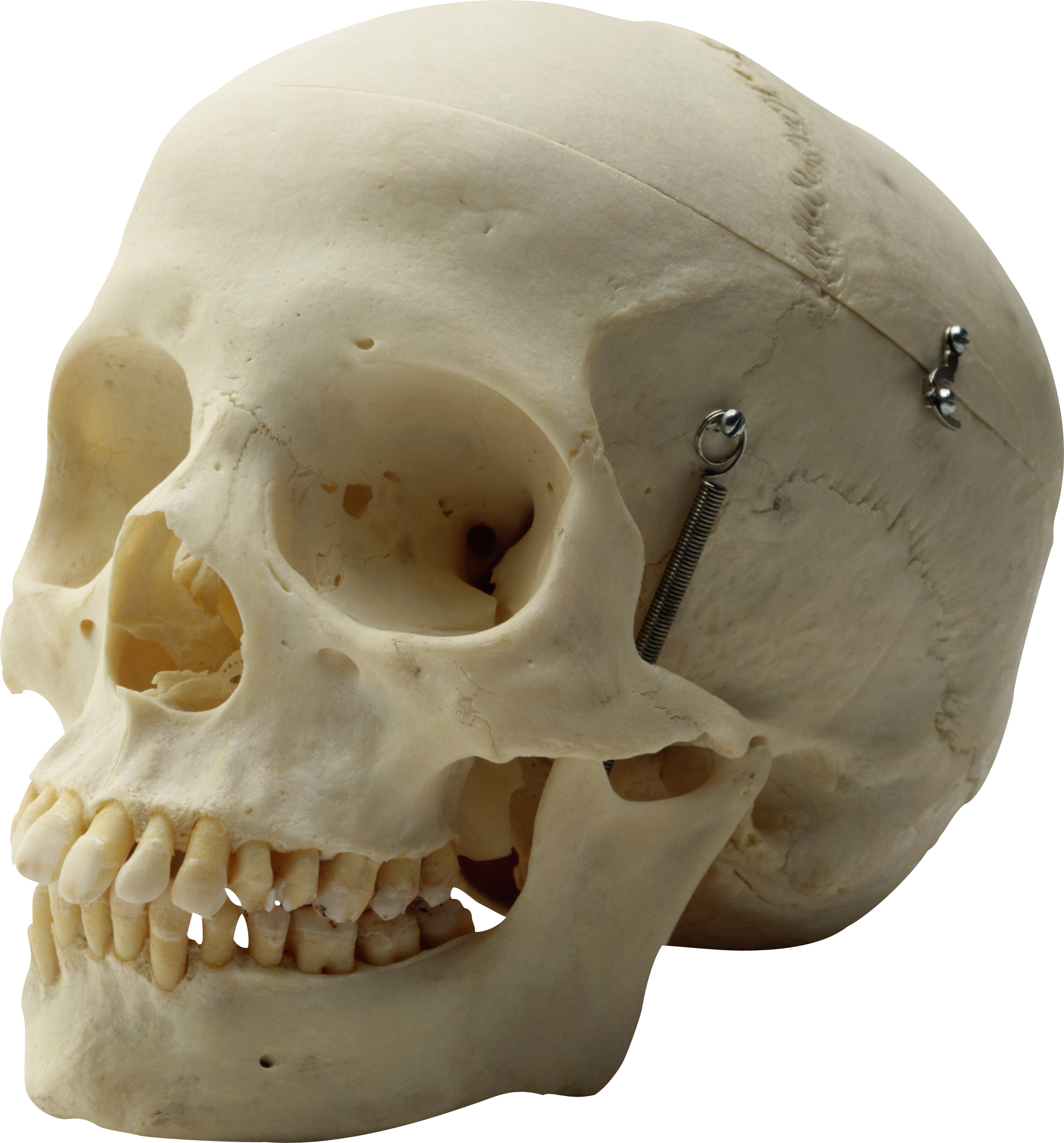 Bone head